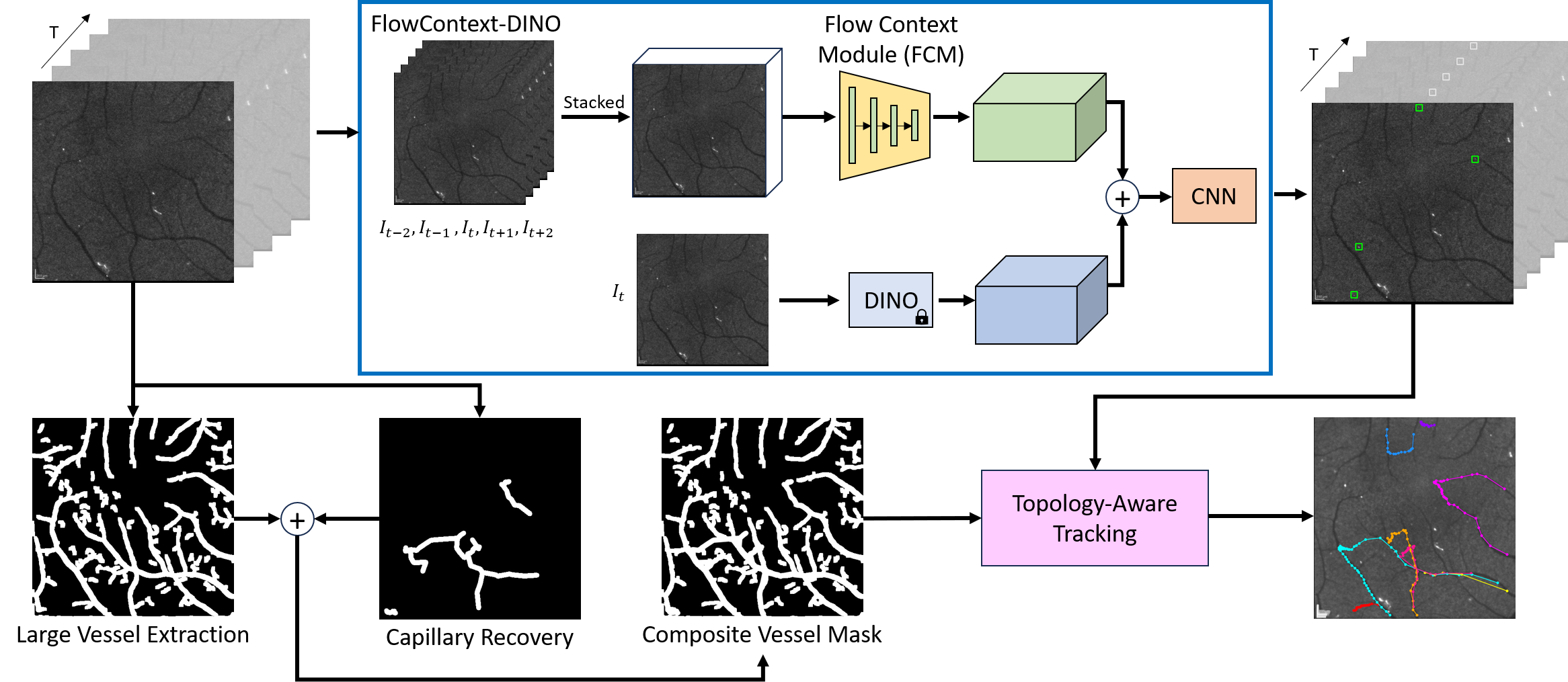 EMTrack
